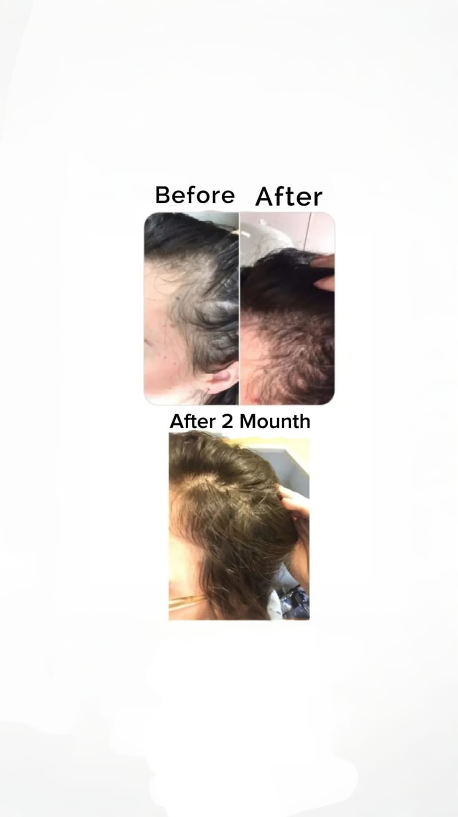 Hofu Hair oil