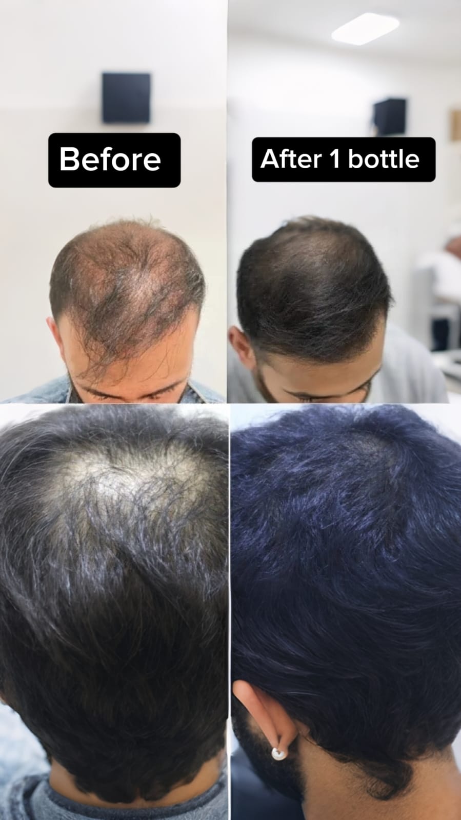 Hofu Hair oil